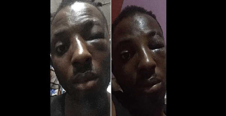 Nigéria: Une femme embauche des hommes pour tabasser son petit ami