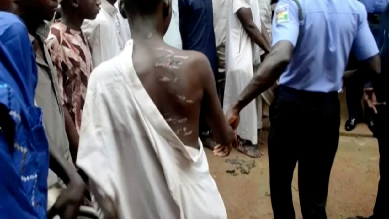 Horreur à Kédougou: Un infirmier ligote un garçon de 15 ans et le viole sauvagement