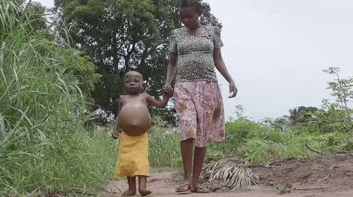 RDC : Une fillette de 6 ans meurt de faim après avoir mangé du sable