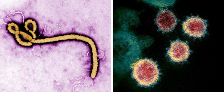Le virus Ebola à gauche, le Sars-CoV-2 à droite. Photos CDC Global (CC BY) et NIAID RML. NIH