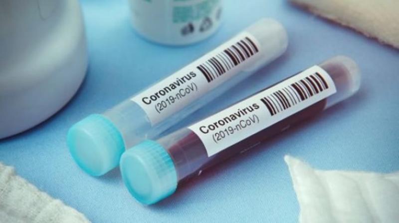 CORONAVIRUS: 66 CONTACTS DONT 14 CAS À HAUT RISQUE, RECENSÉS À RICHARD-TOLL