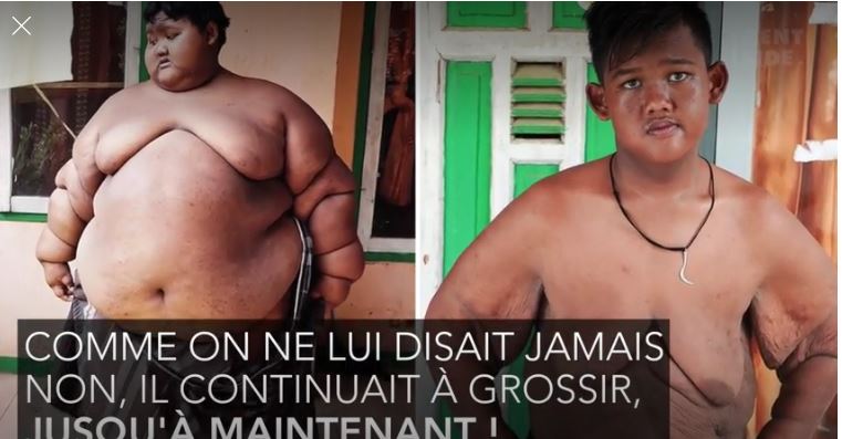 L'enfant qui pesait 190 kilos s'est métamorphosé