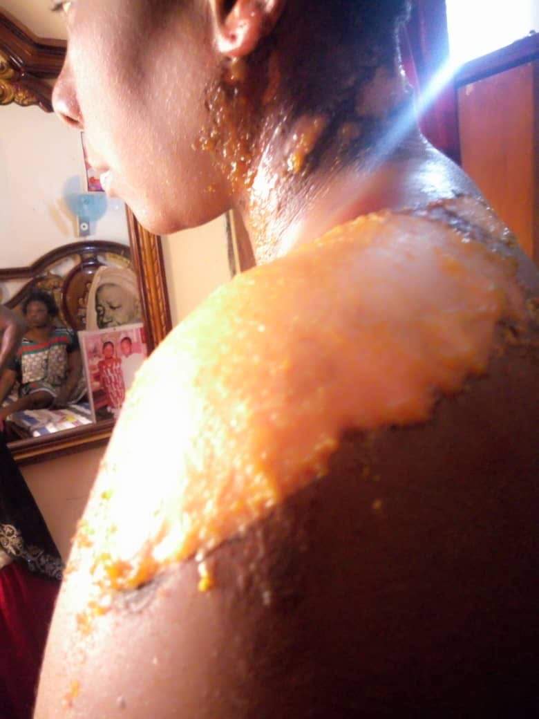 VIDEO - Diakhaye: Une femme verse du thé chaud sur sa coépouse