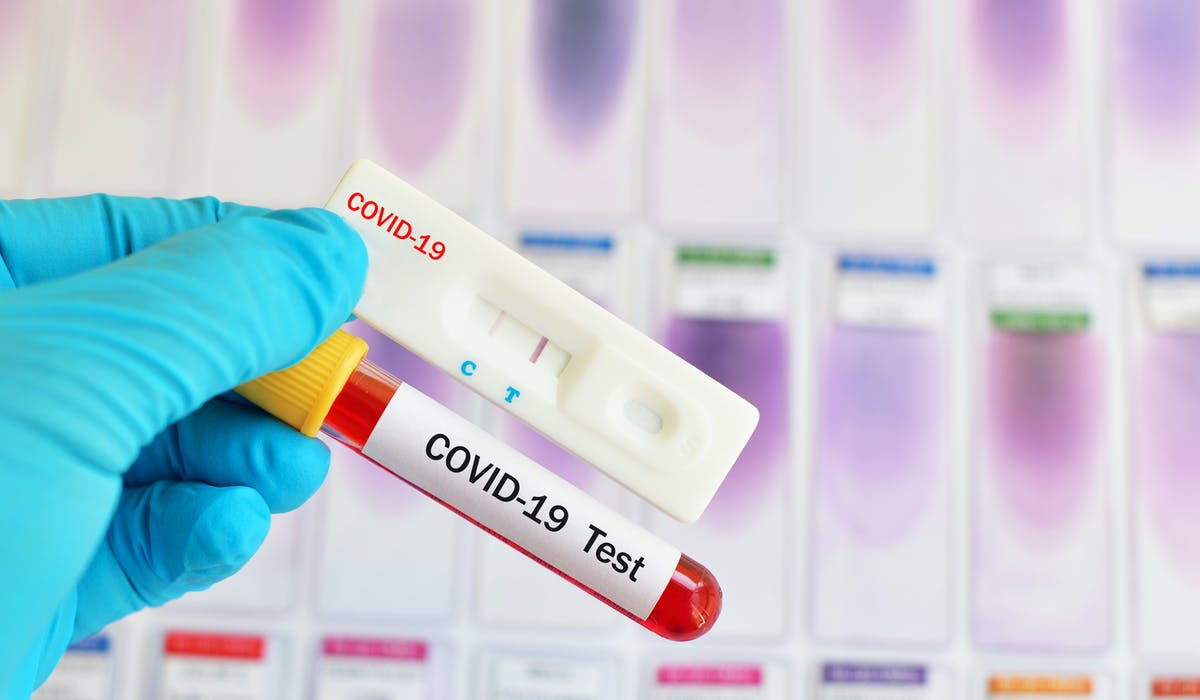 Covid 19:Le ministère de la Santé arrête les tests sur les cas asymptomatiques...