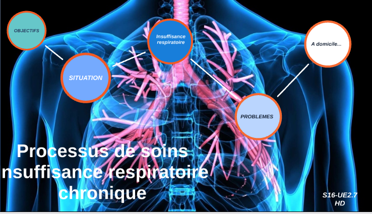 Covid-19 / Insuffisance respiratoire chronique: Ces personnes atteintes, invitées à se faire vacciner