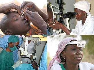 Santé oculaire: 50 000 cas de cataracte en attente de chirurgie.