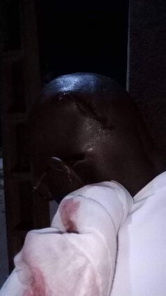 Photos / Convoi de Ousmane Sonko attaqué : Les images de l’agression publiées