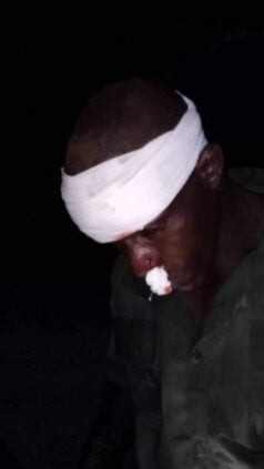 Photos / Convoi de Ousmane Sonko attaqué : Les images de l’agression publiées
