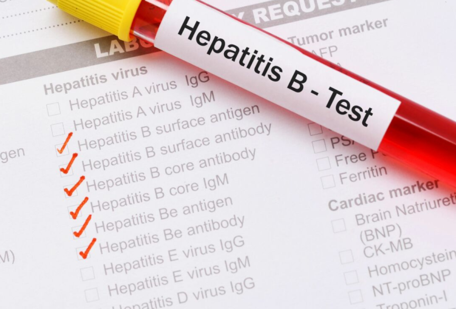Passy : L’hépatite B à l’origine de 80% des causes de mortalité chez les jeunes (Pharmacien)
