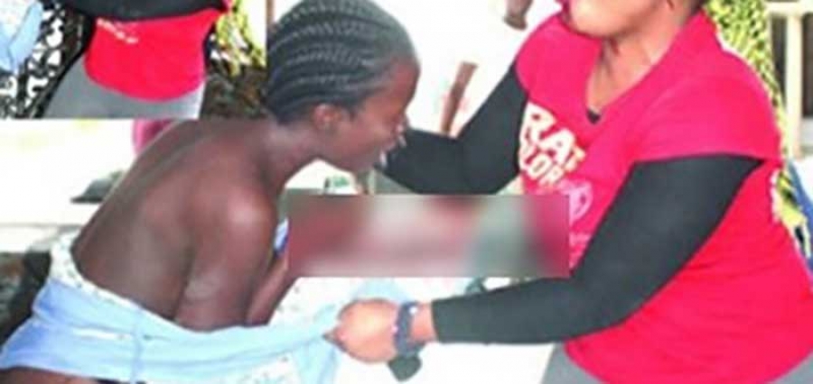 Nigeria: Une mère arrache l’oreille de sa fille pour avoir couché avec son copain