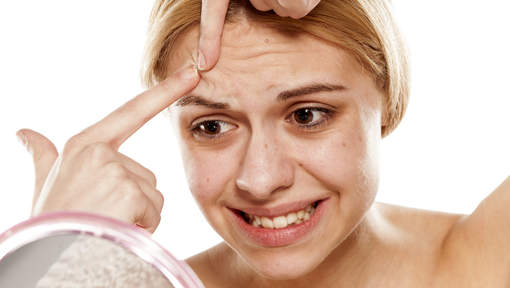 Ce que l'endroit où apparaît votre acné dit de votre santé