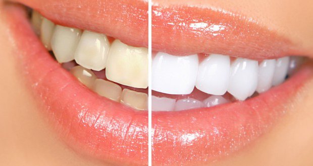 Mâchez cet aliment pour éliminer la plaque dentaire et prévenir les caries