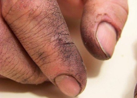 Un recruteur lui demande de laver les mains de son père lors d'un entretien d'embauche... Ce qu'il a dit ensuite m'a mis les larmes aux yeux !