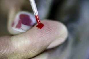 Révolution médicale : Le test VIH à faire seul chez soi maintenant en vente en pharmacie