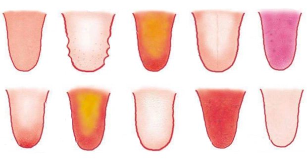 8 problèmes de santé révélés par votre langue