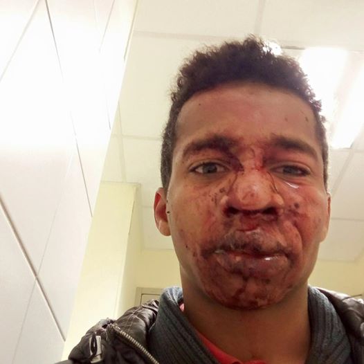 La police accusée de violences sur ce jeune homme en Vendée