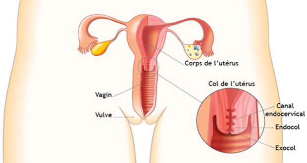 Voici comment prévenir le cancer du col de l’utérus ?