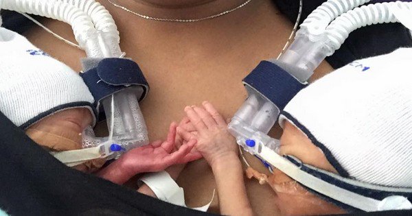 Deux minuscules bébés, nés prématurément, refusent de se lâcher la main... Magnifique !