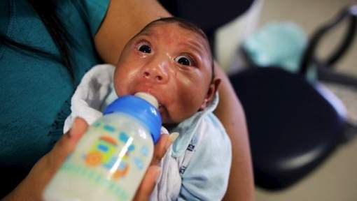 Bébés malformés: et si Zika n'était pas en cause?