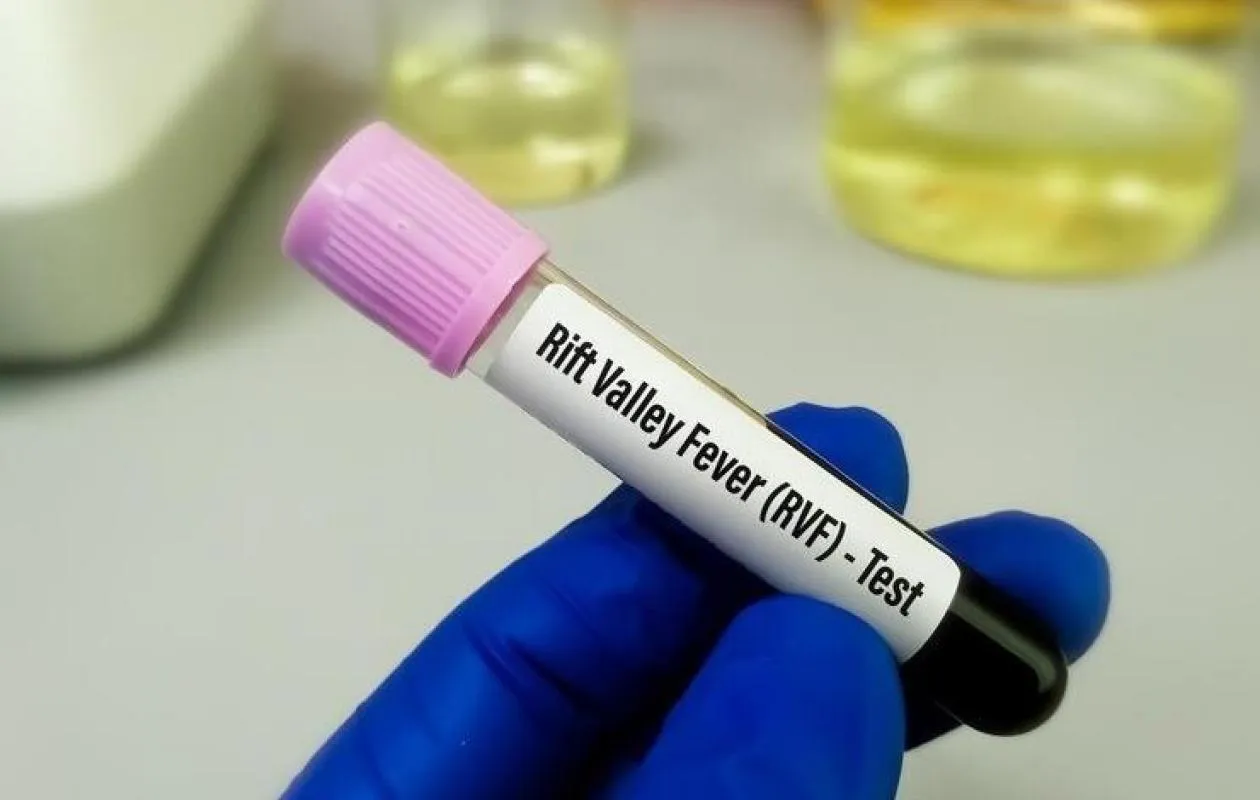 Santé : 277 cas de fièvre de la Vallée du Rift et 7 cas de Mpox recensés au Sénégal