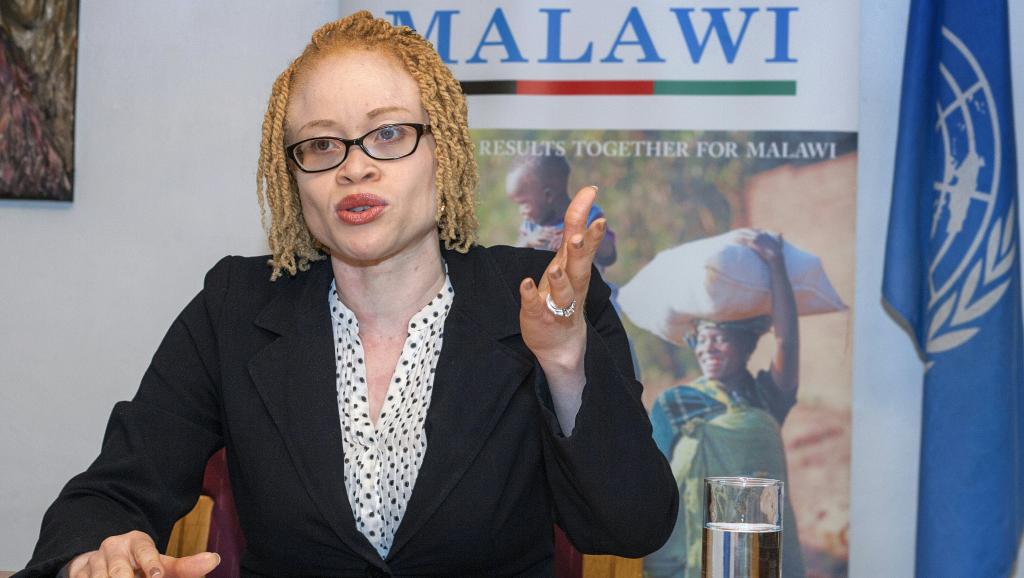 La Nigériane Ikponwosa Ero, experte indépendante de l'ONU sur la question des personnes atteintes d'albinisme et albinos elle-même, a mené une mission de 12 jours au Malawi
