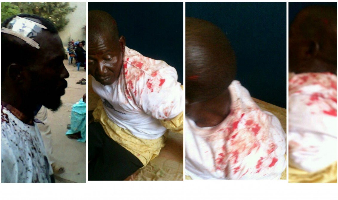 Gambie - Une manifestation pacifique d'opposants tourne au bain de sang : 12 blessés graves et 42 manifestants arrêtés