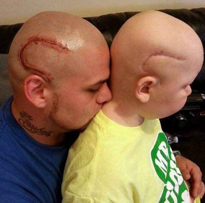 Il se fait tatouer la même cicatrice que son fils atteint d'un cancer pour le soutenir dans cette épreuve... Magnifique !