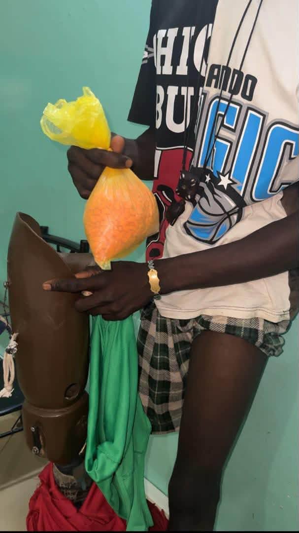 Karang : les Douanes saisissent 1 590 pilules d’ecstasy dissimulées dans une prothèse de jambe