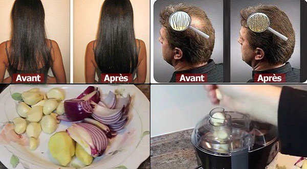 Elle avait des cheveux fins mais elle a utilisé cet ingredient. Voici le résultat