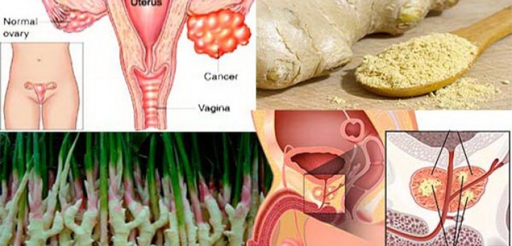 Le gingembre tue les cellules du cancers des ovaires