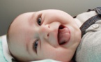 Atteint d'un syndrome rare, un bébé naît avec une langue disproportionnée