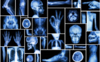le 8 novembre, Journée internationale de la radiologie