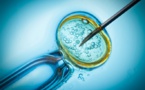 26 femmes potentiellement inséminées avec le mauvais sperme :Des ovocytes fécondés avec un sperme qui n'appartenait pas forcement à leur compagnon