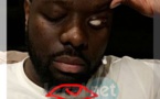 Vidéo: Illumunati, Franc-maçonnerie, sorcellerie, Maître Gims répond aux accusations et montre son oeil..