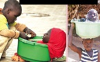 Nigéria: Elle n’a qu’une tête, un tronc et des bras, et peut vivre dans un petite bassine (vidéo)