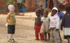COMMUNIQUE DE PRESSE-Dans le cadre de ses activités d’aide et de soutien aux personnes les plus vulnérables : Talibés, personnes atteintes d’Albinisme, et personnes en situation de Handicap,