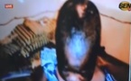 Par jalousie, elle verse de l'acide sur le visage des filles de sa co-épouse