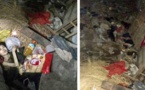 Ses parents l'ont enfermée dans un cabanon, elle s'y trouve depuis 6 ans !