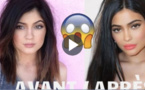 Avant / Après : Kylie Jenner, son incroyable transformation physique