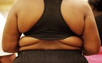 Obésité : 1 femme sur 4 touchée