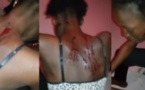 Femme battue à Touba:  Intimidations et pressions pour étouffer l’affaire (Audio)