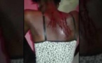 Femme battue à Touba : Ecoutez la version de la famille du mari!