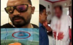 Horreur en Inde : Un homme crève l’œil de son père. La raison (vidéo)