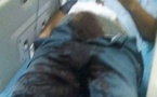 Mbour: Du nouveau sur l’homme agressé au sexe coupé et emporté