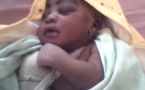 DRAME A L’HOPITAL HEINRICH LUBKE REGIONAL DE DIOURBEL: Un nouveau-né sort de la maternité, l’avant-bras fracturé