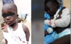 Mbour: L‘enfant torturé par sa belle-mère raconte son calvaire