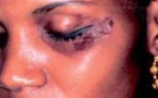 Dépigmentation cosmétique volontaire: Les spécialistes statueront ce samedi sur ses complications 