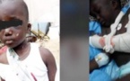 Affaire de l’enfant "torturé" à Mbour: La belle-mère relaxée !