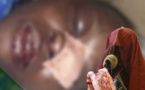 VIDEO - Défigurée par son mari, Gnima Mendy fait des révélations choquantes