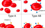 Des chercheurs affirment avoir établi un lien entre un groupe sanguin et le risque d’infection au coronavirus